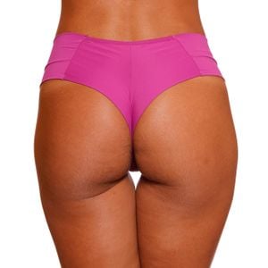 Calcinha Fio Dental Duplo Lorrane Com Renda Fortal Lingerie